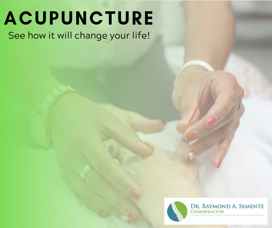 Acupuncture in St. James