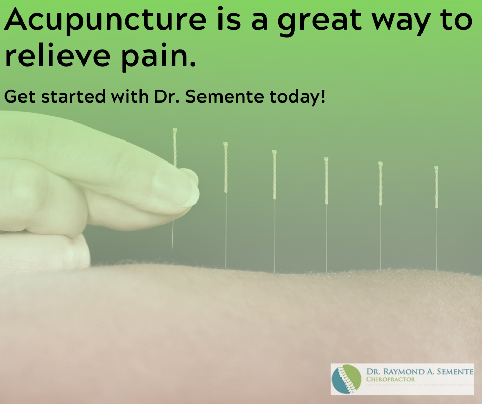 Acupuncture Near Smithtown