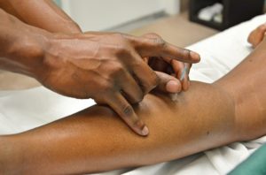 acupuncture in st. james